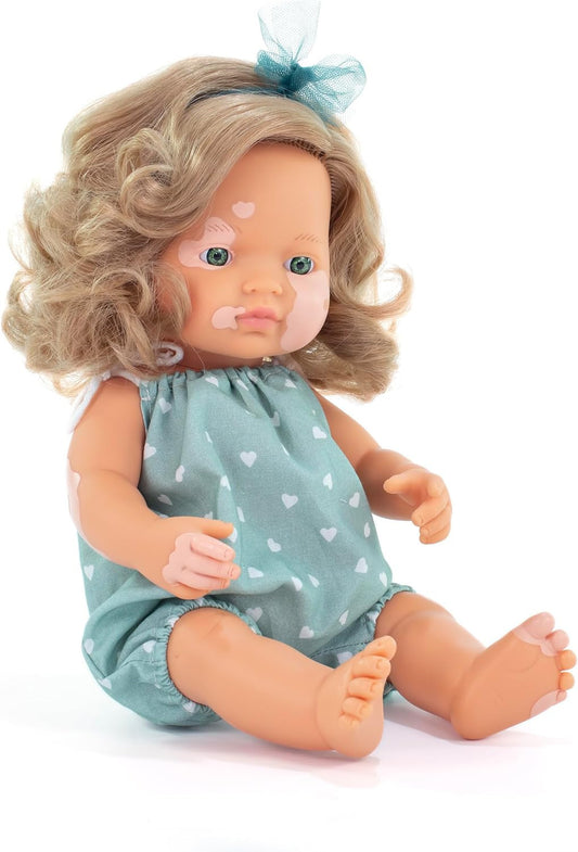 Inclusive Dolls- My Friends and Me Doll Collection - Blonde Caucasian Girl (With Vitiligo)